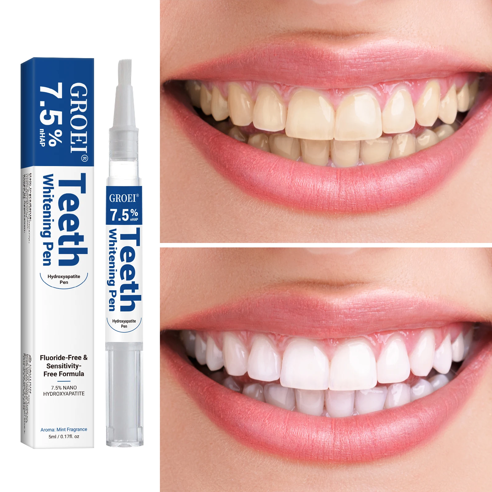 Hydroxyapatite Tooth Whitening – обзор и цена Teeth Whitening Gels Used By Dentists