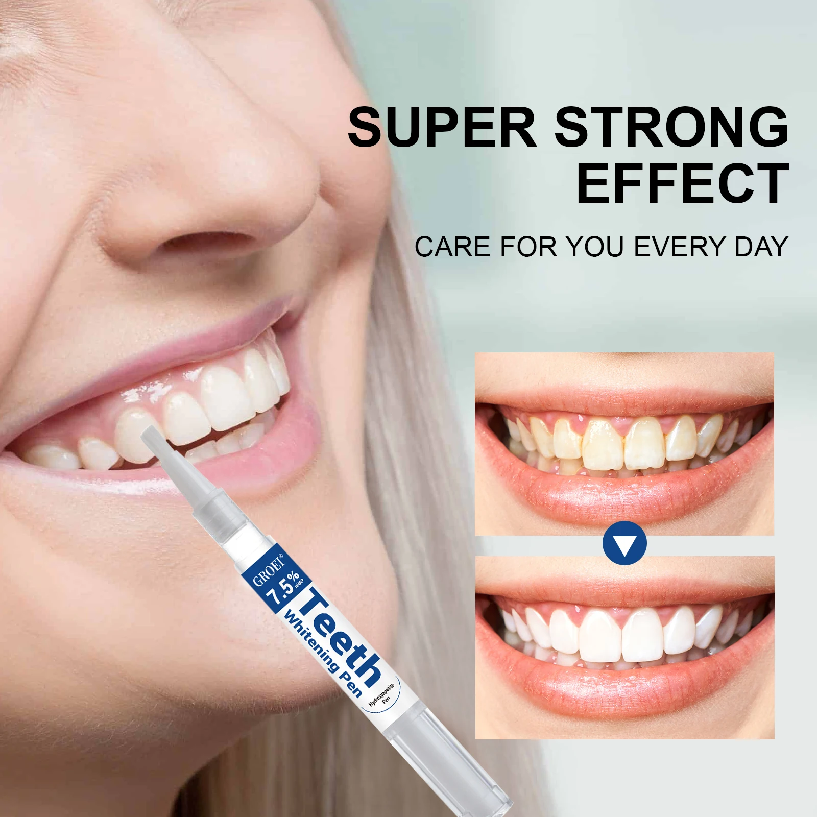 Hydroxyapatite Tooth Whitening – обзор и цена Teeth Whitening Gels Used By Dentists