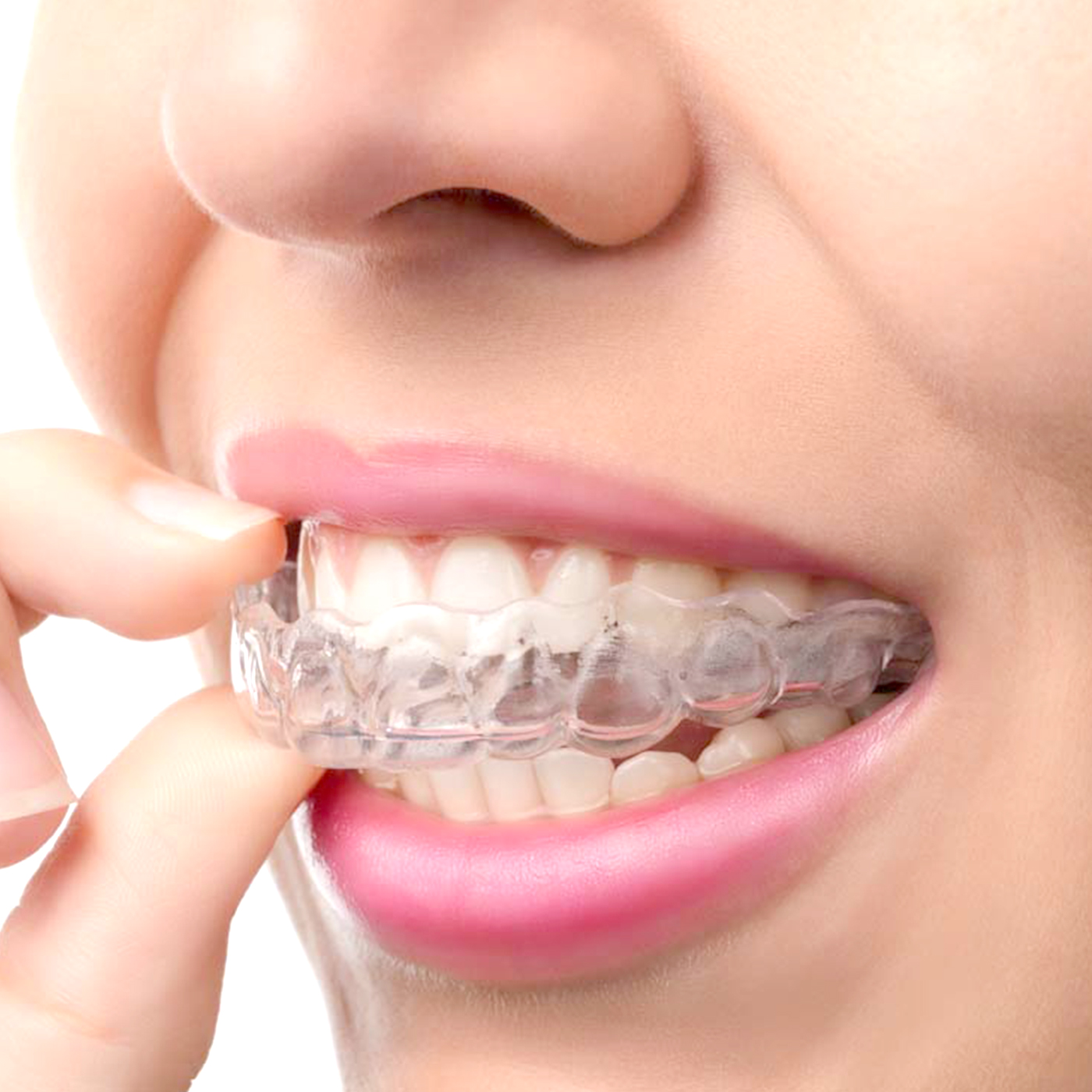 1Pc/2Pcs Transparent Teeth Tra – обзор и цена Teeth Whitening For Trays