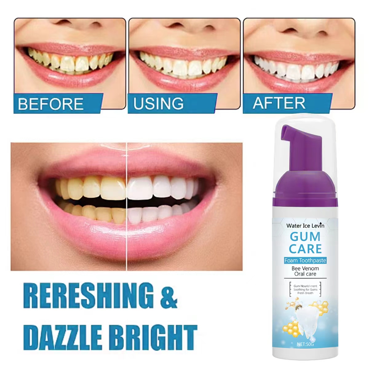 Water Ice Levin Gum Care Foam  – обзор и цена Teeth Whitening Xylitol