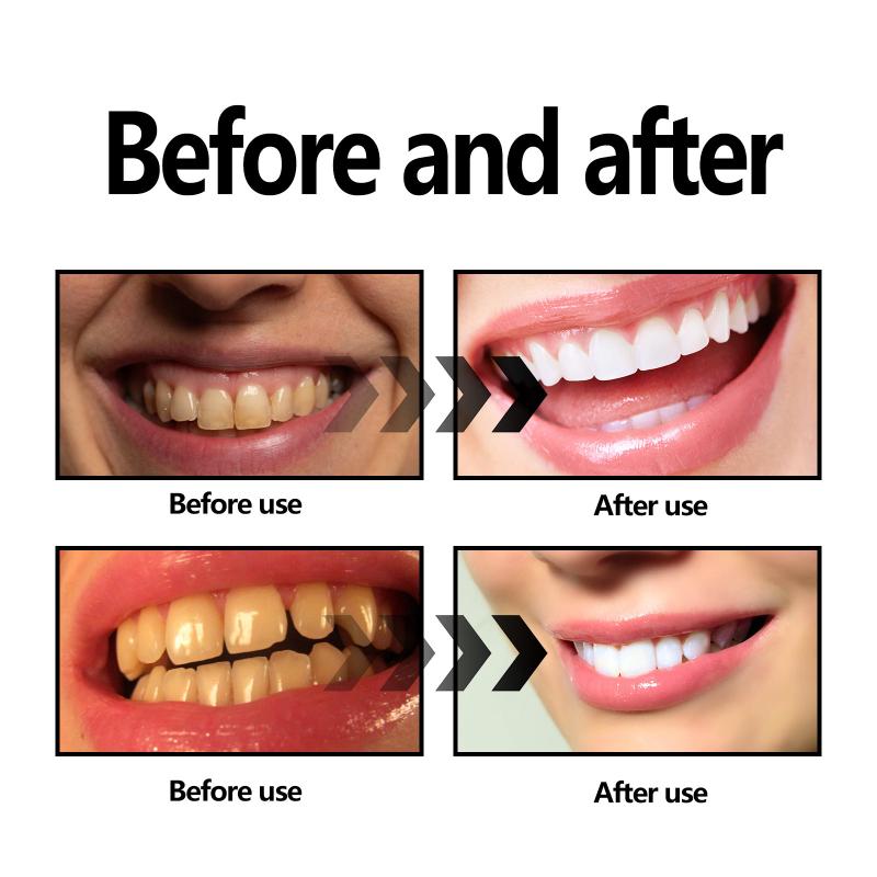 Teeth Whitening Powder Charcoa – обзор и цена Whitening Teeth Using Baking Soda