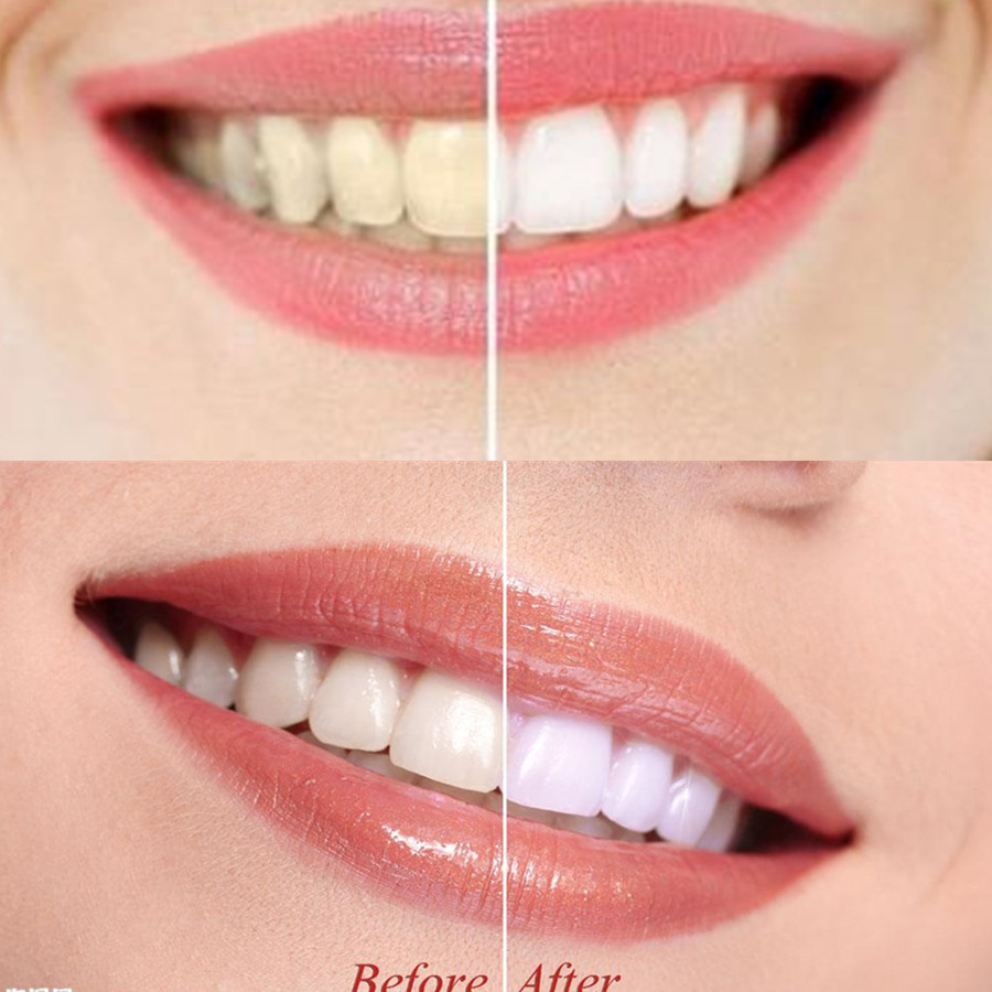 Bamboo Charcoal Teeth Tooth De – обзор и цена Teeth Whitening Ingredients