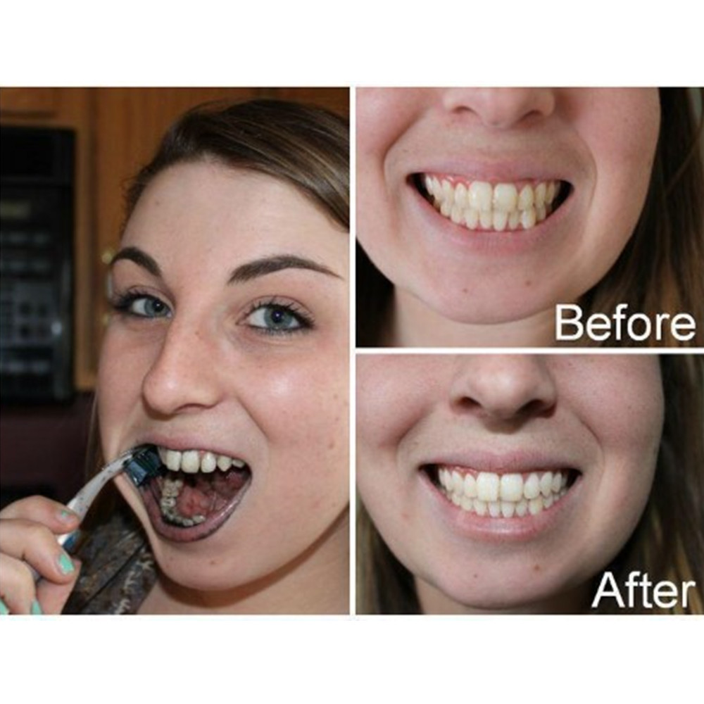 Bamboo Charcoal Teeth Tooth De – обзор и цена Teeth Whitening Ingredients