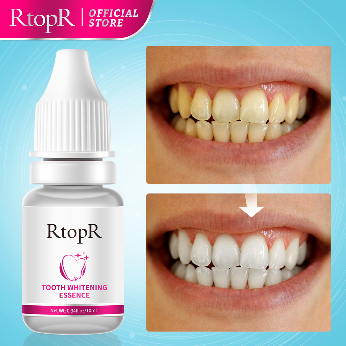 Tooth Whitening Serum Whitenin – обзор и цена Teeth Whitening Xylitol