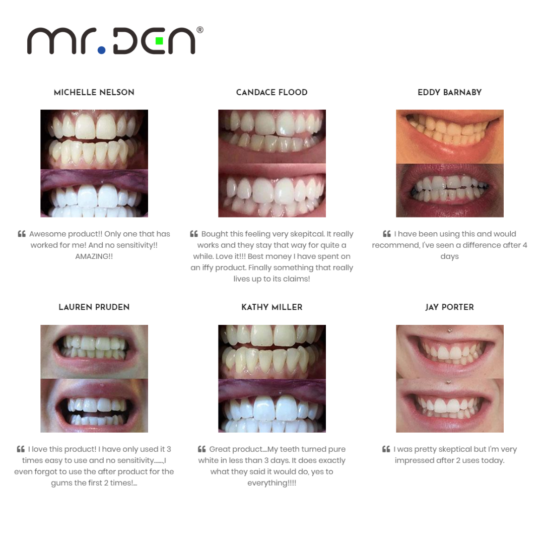Dr. Whiten 3 Pack Teeth Whiten – обзор и цена Teeth Whitening Light Kit
