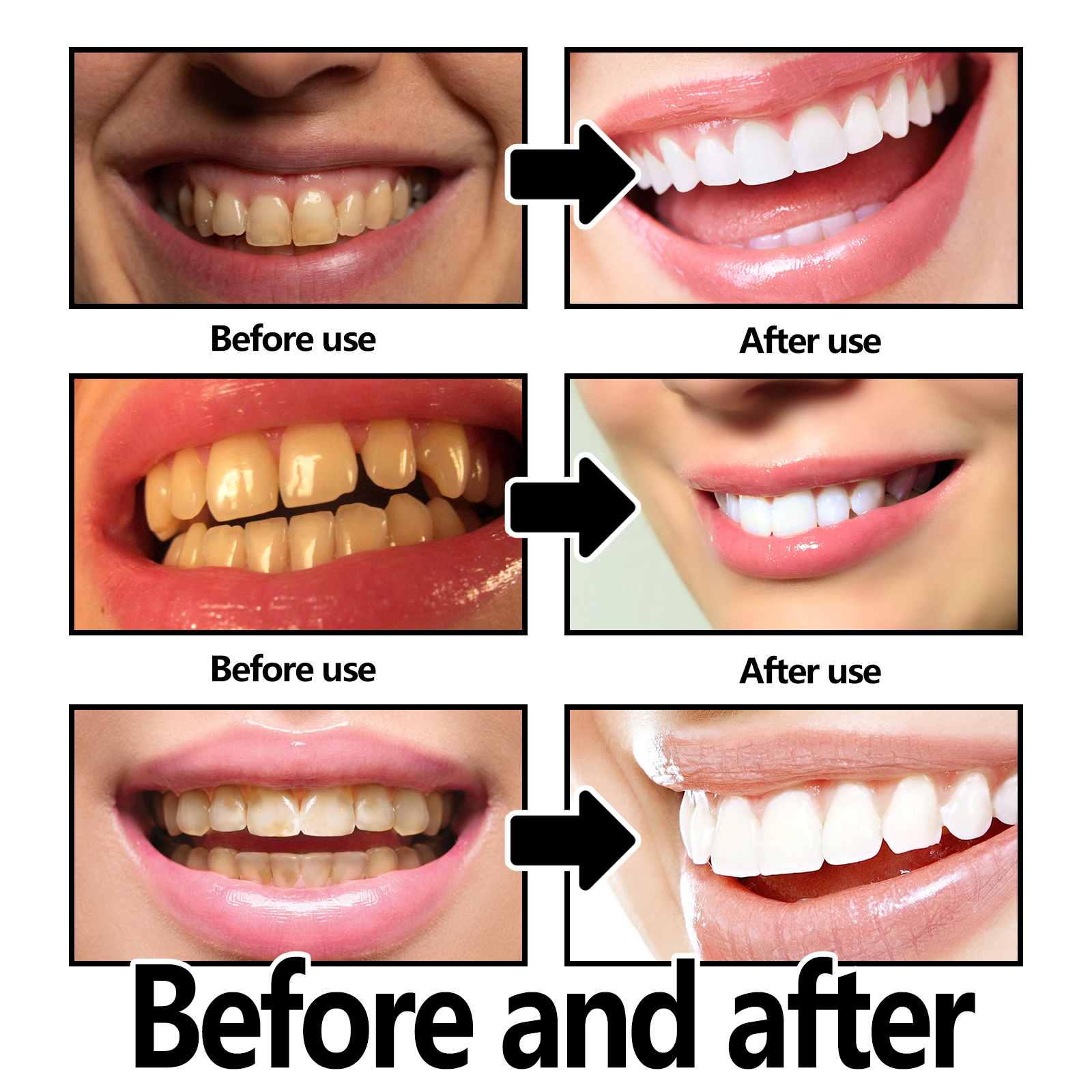 Xylitol Mint Purple Toothpaste – обзор и цена Teeth Whitening Xylitol