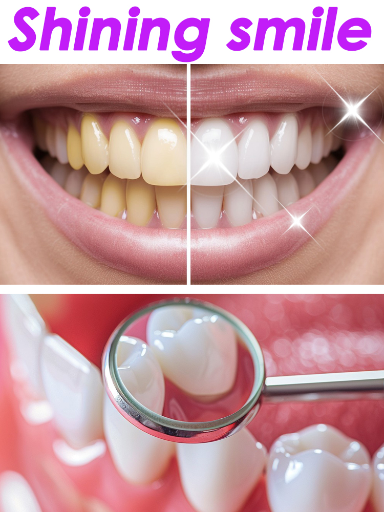 GlorySmile Teeth Whitening Fru – обзор и цена Teeth Whitening Xylitol
