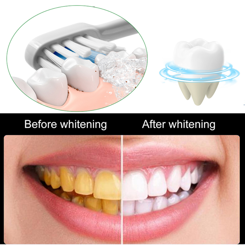 Useful Toothpaste Prevent And  – обзор и цена Whitening Teeth Using Baking Soda