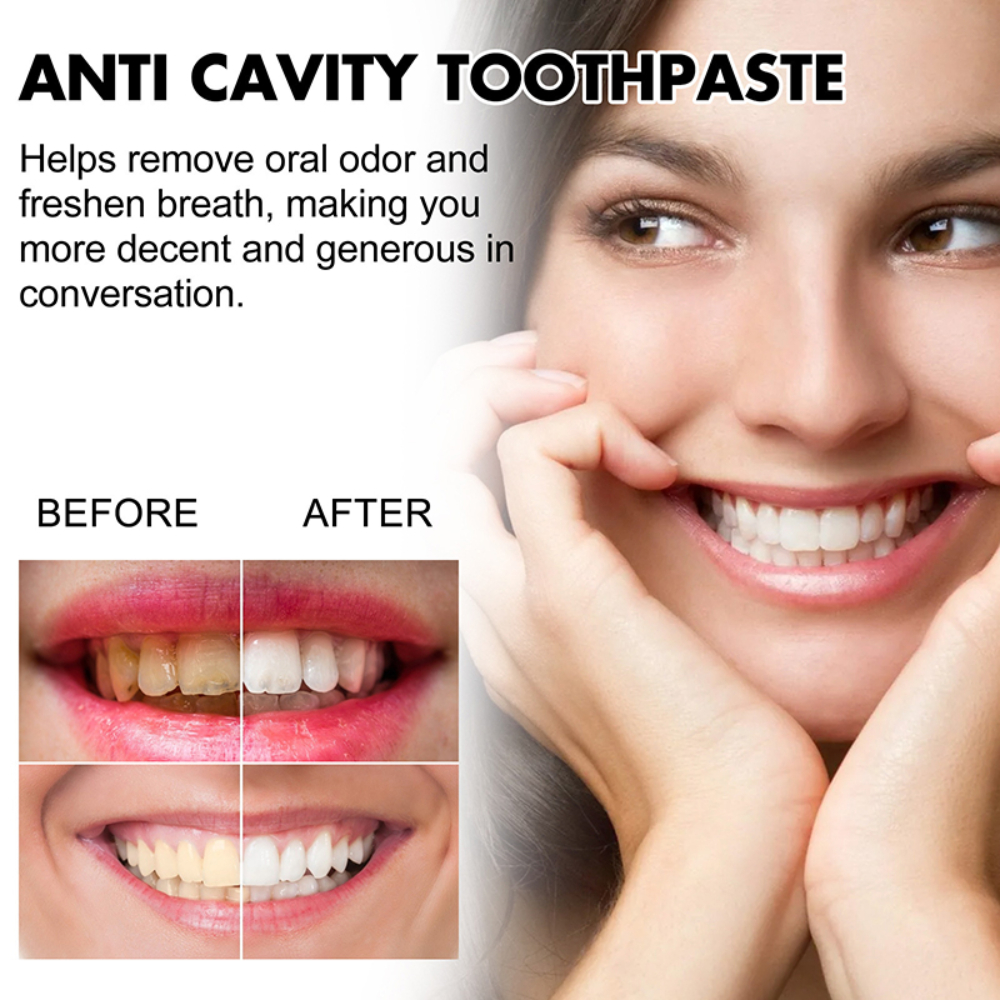 Useful Toothpaste Prevent And  – обзор и цена Whitening Teeth Using Baking Soda