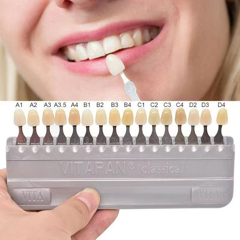 VITA 16 Colors Teeth Shade Gui – обзор и цена Teeth Whitening For Trays