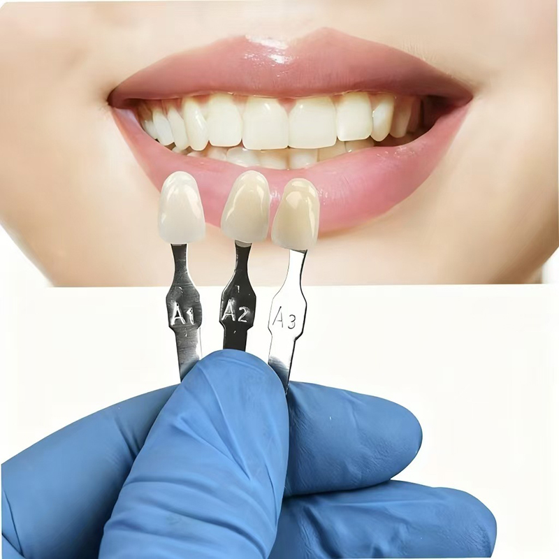 VITA 16 Colors Teeth Shade Gui – обзор и цена Teeth Whitening For Trays