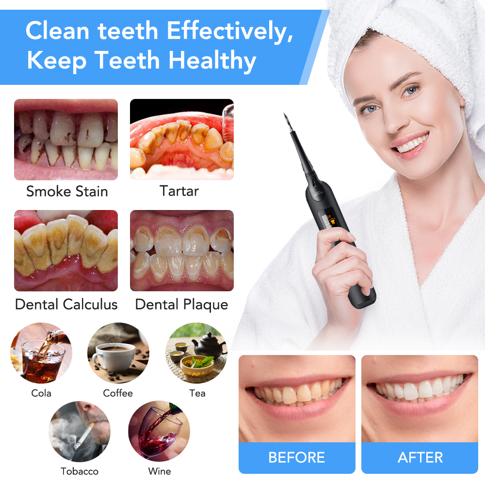 Teeth Tartar Remover Electric  – обзор и цена Teeth Whitening Light Kit