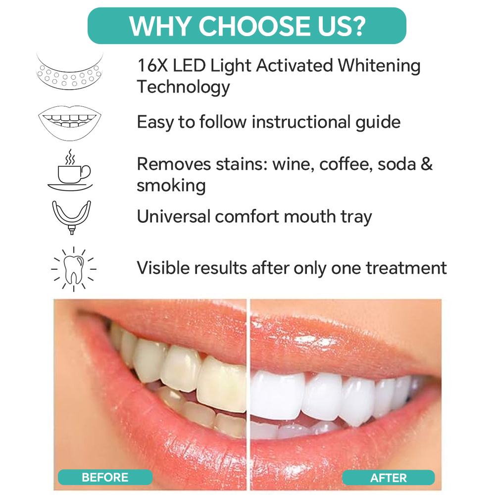 Teeth Whitening Accelerator Li – обзор и цена Teeth Whitening (Bleaching)