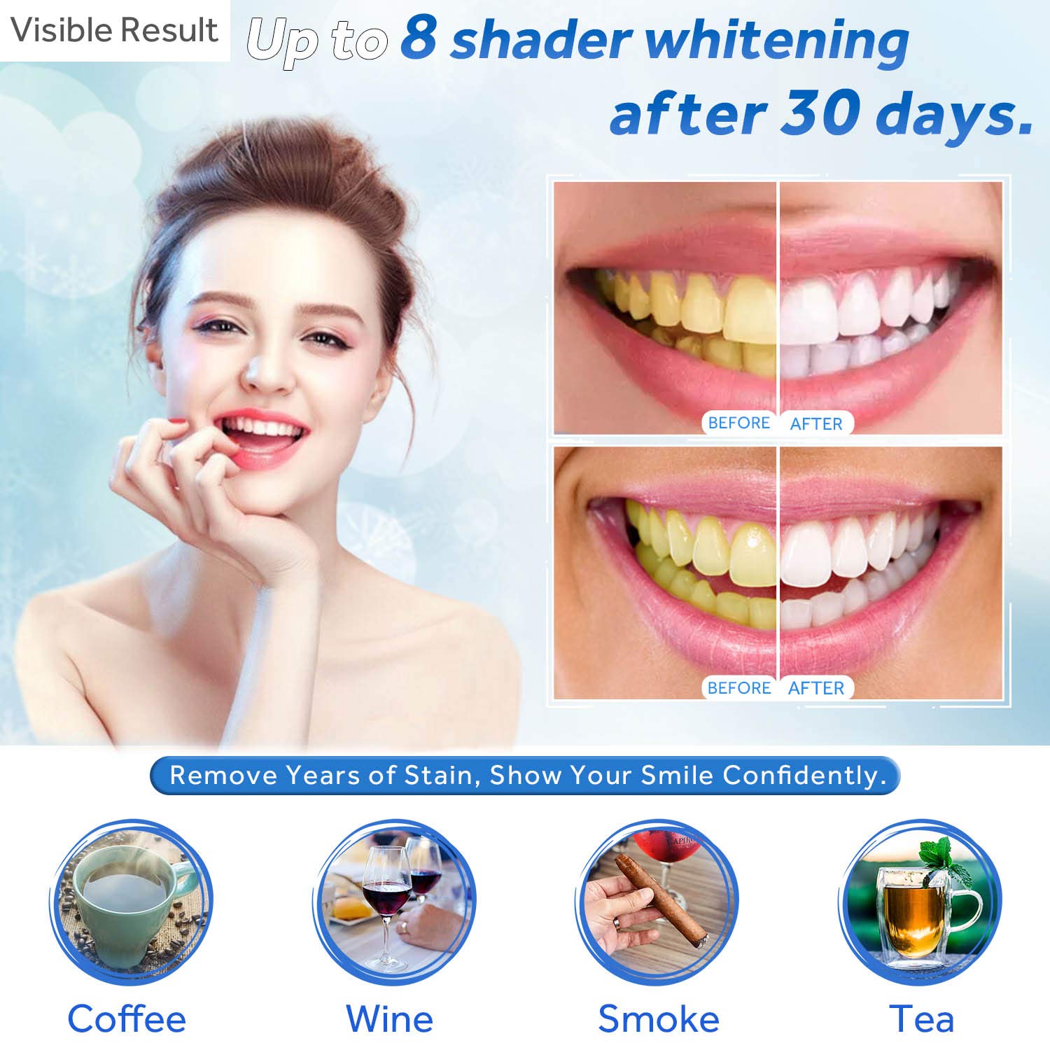 Teeth Whitening Gel Refill Syr – обзор и цена Teeth Whitening Gels Used By Dentists