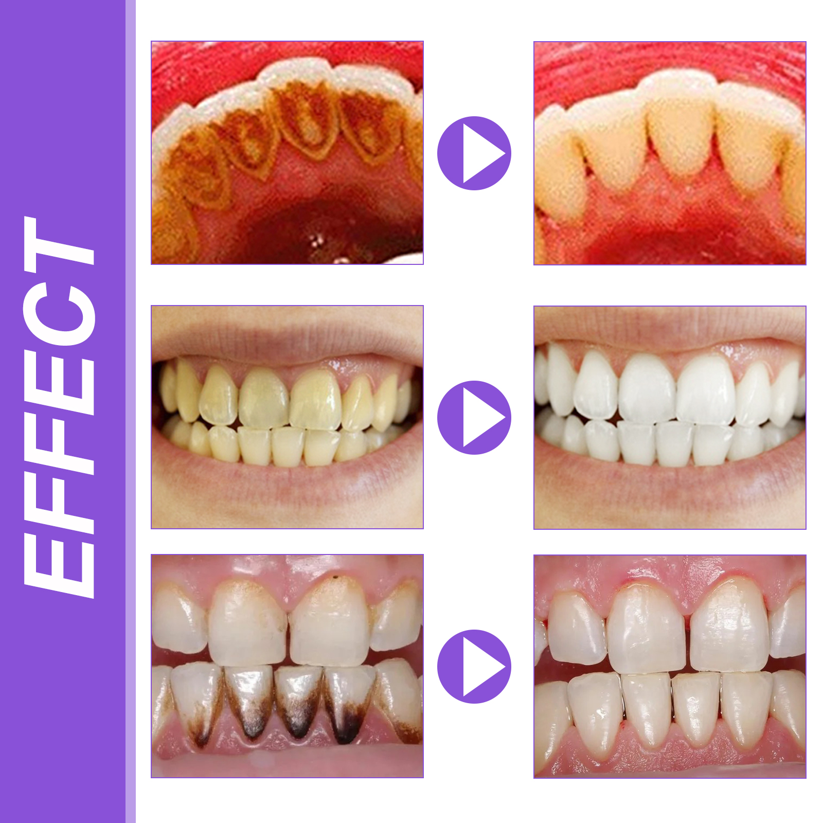 EELHOE Smiles Bright White Ref – обзор и цена Teeth Whitening Ingredients