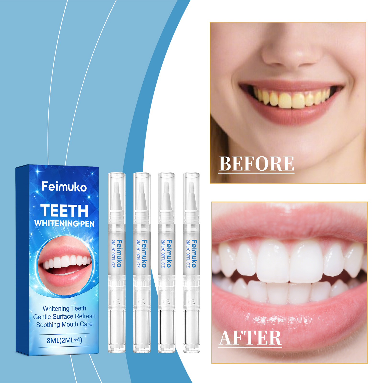 Feimuko 8ml Teeth Gel Pen Gent – обзор и цена Teeth Whitening Gels Used By Dentists