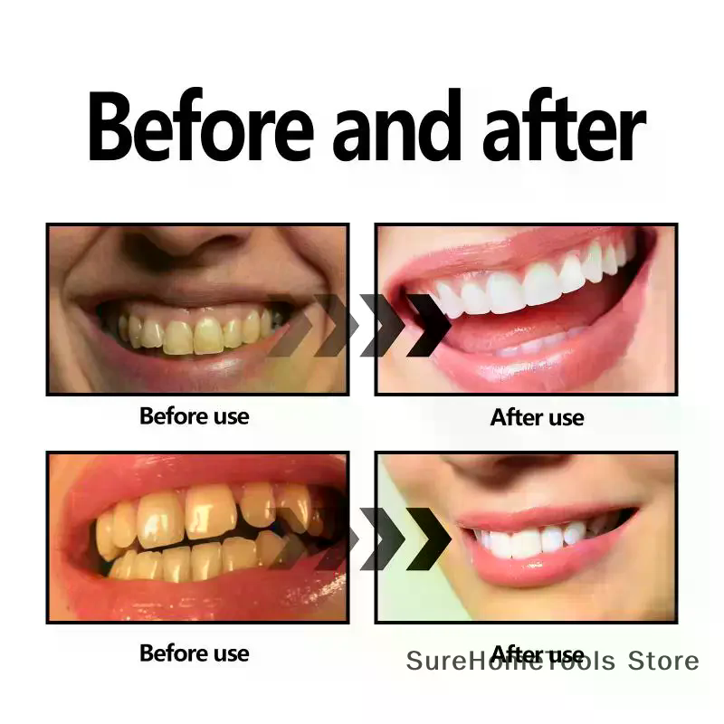 Bamboo Charcoal Powder For Tee – обзор и цена Teeth Whitening Ingredients