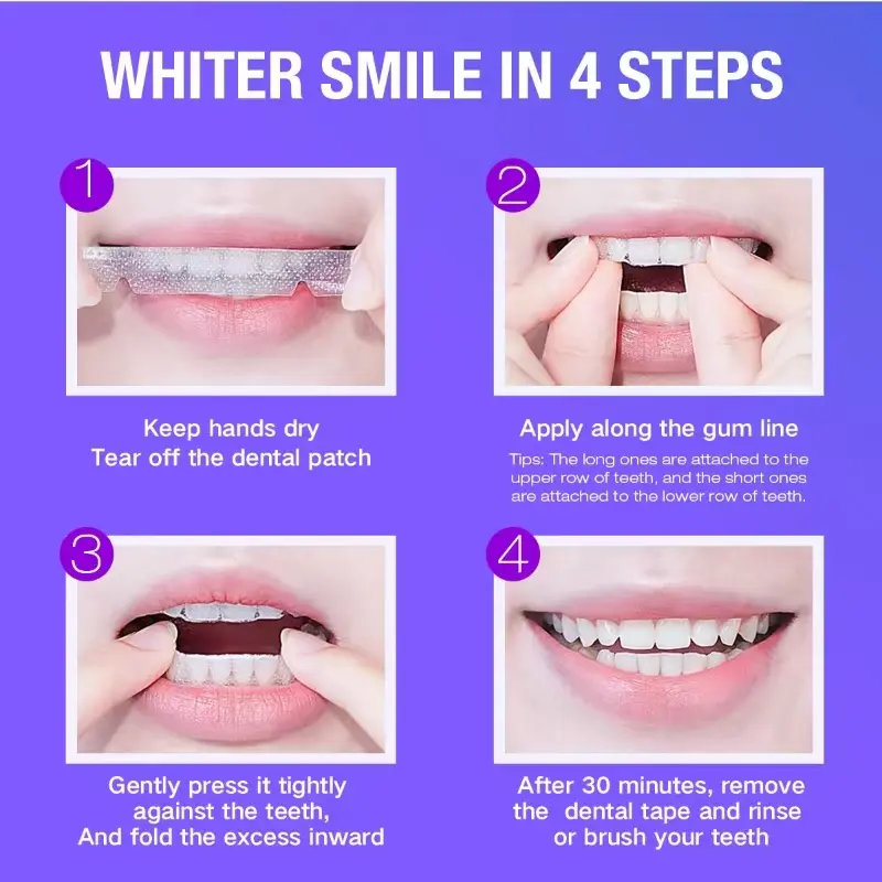 Teeth Whitening Kit - 5X LED L – обзор и цена Teeth Whitening Strips Crest
