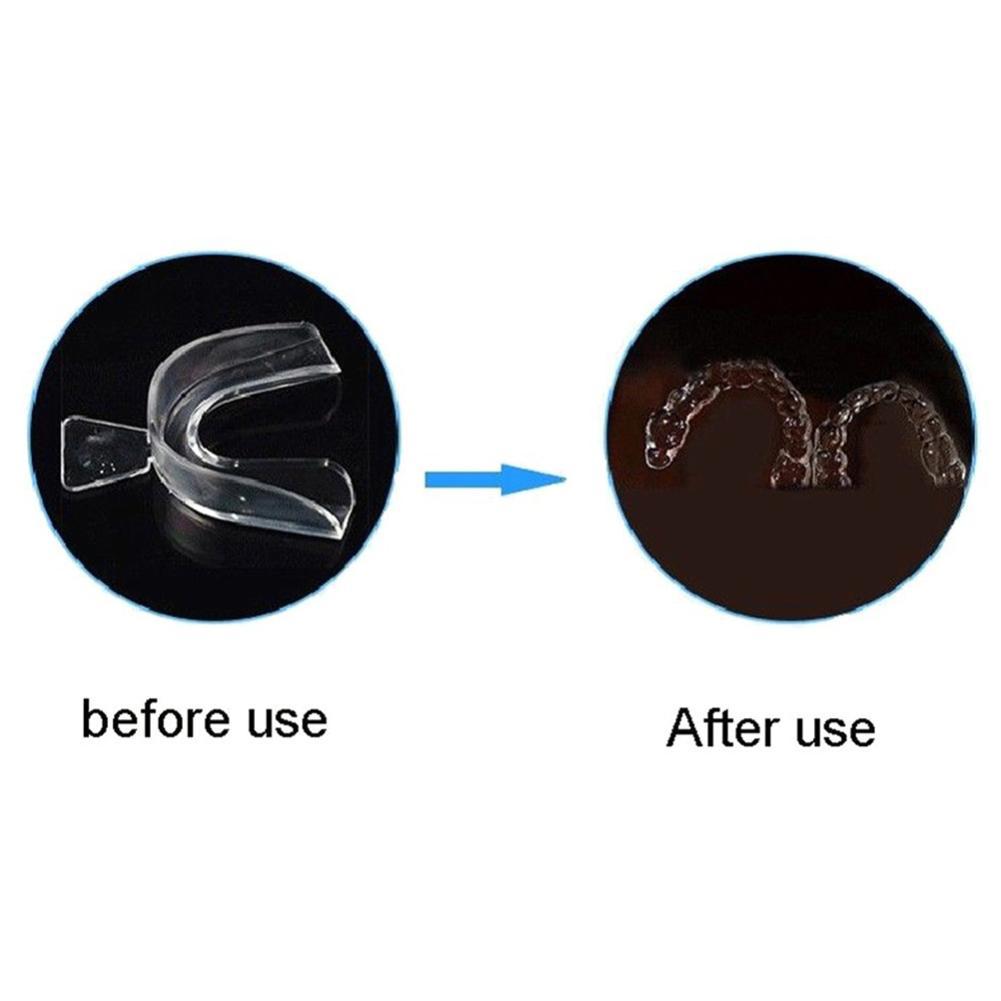 Silicone Mouth Guard Orthodont – обзор и цена Teeth Whitening For Trays