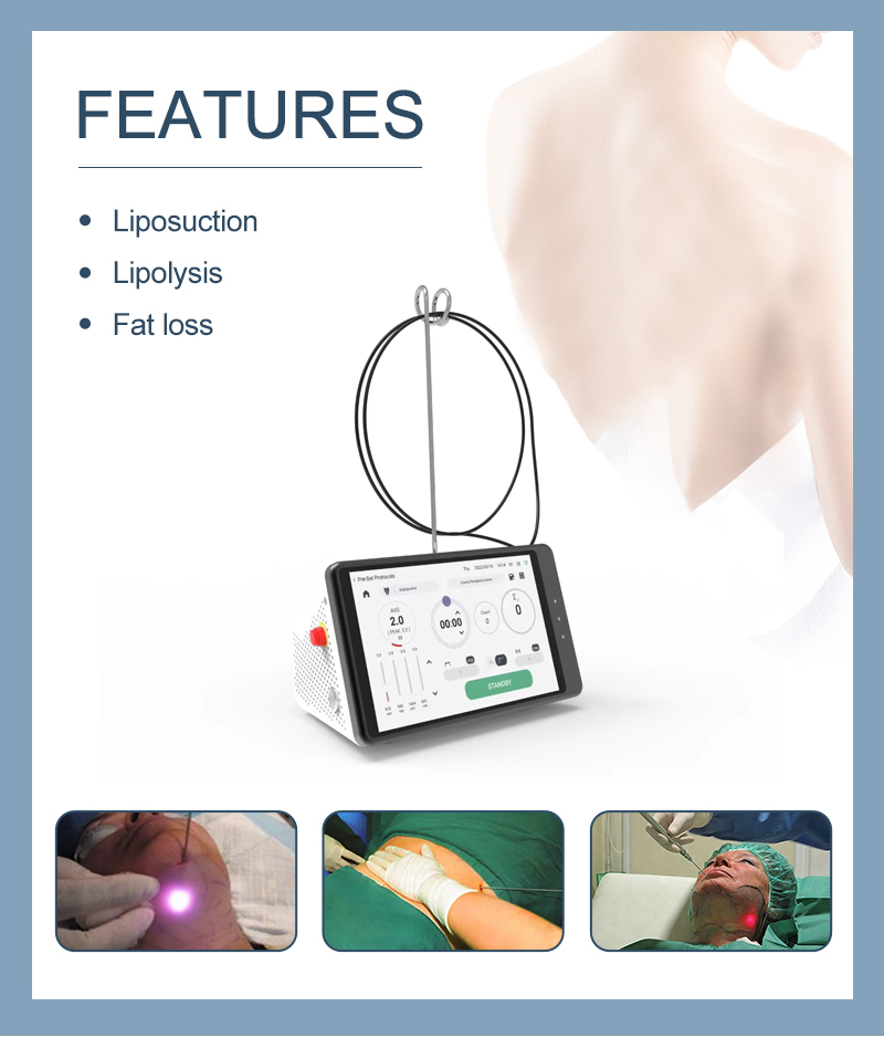 Dental Laser Teeth Whitening D – обзор и цена Teeth Whitening Laser