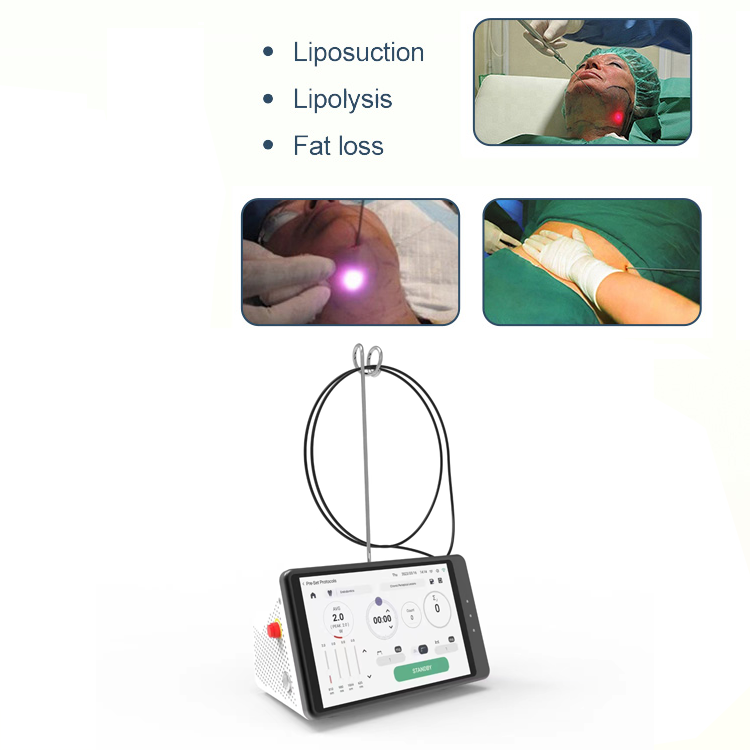 Dental Laser Teeth Whitening D – обзор и цена Teeth Whitening Laser