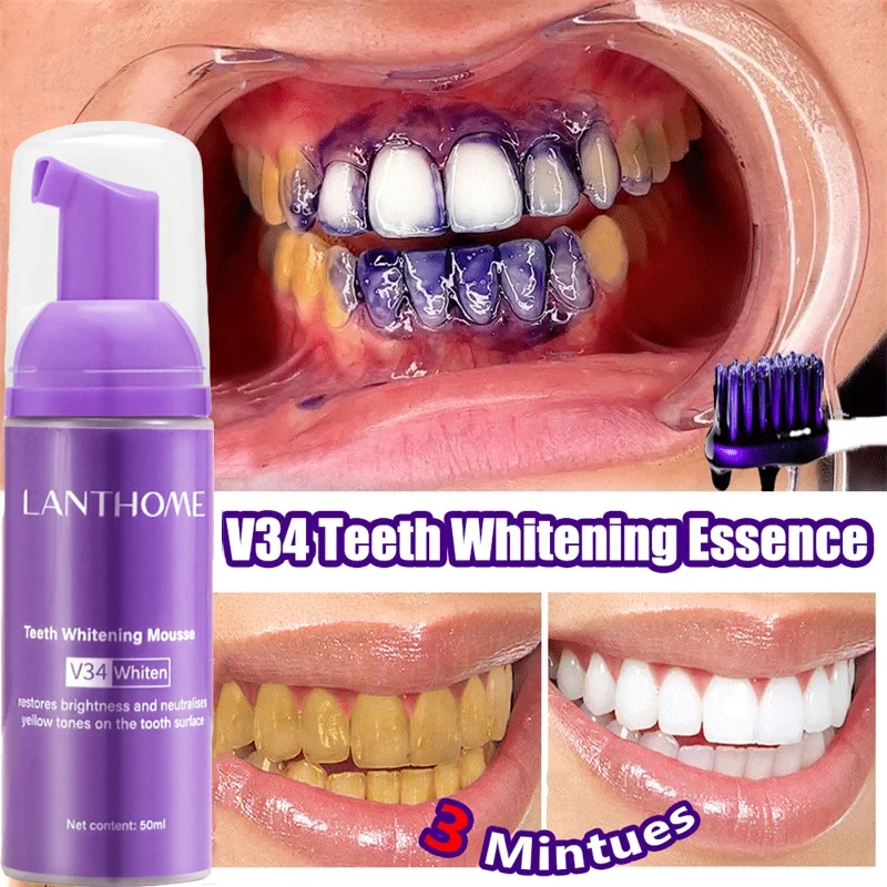V34 Teeth Whitening Mousse Too – обзор и цена Teeth Whitening Xylitol