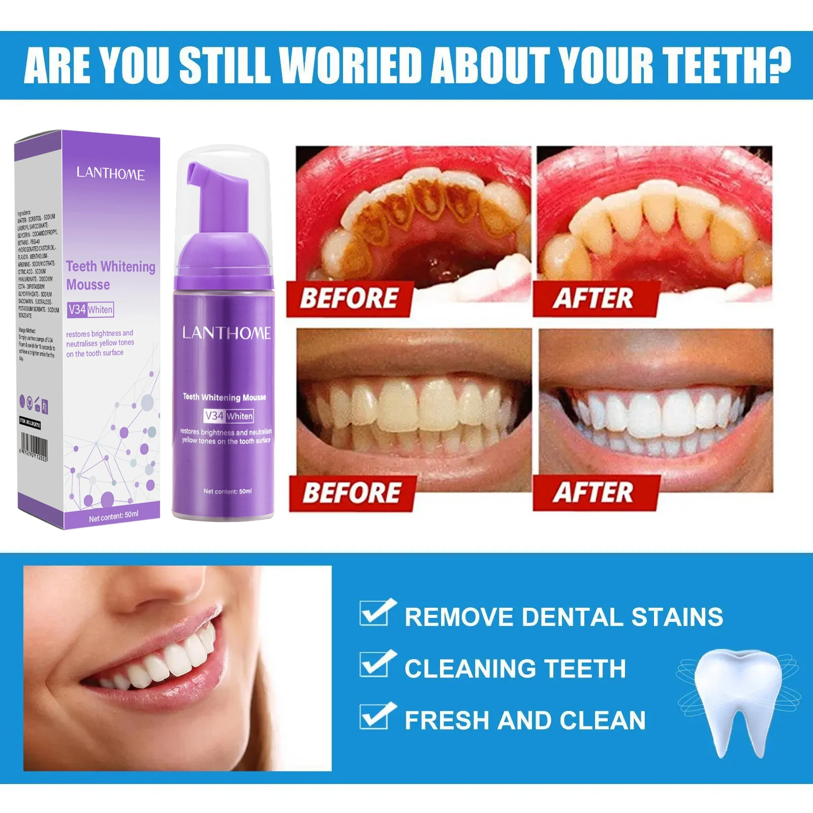 V34 Teeth Whitening Mousse Too – обзор и цена Teeth Whitening Xylitol