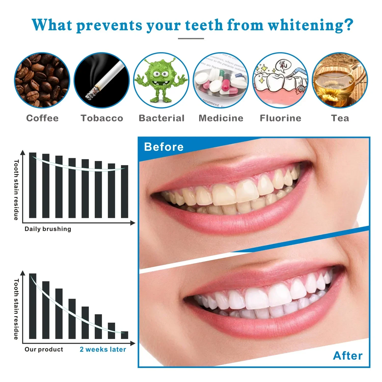 14/28pcs 3D Teeth Whitening St – обзор и цена Whitening Strip 3D