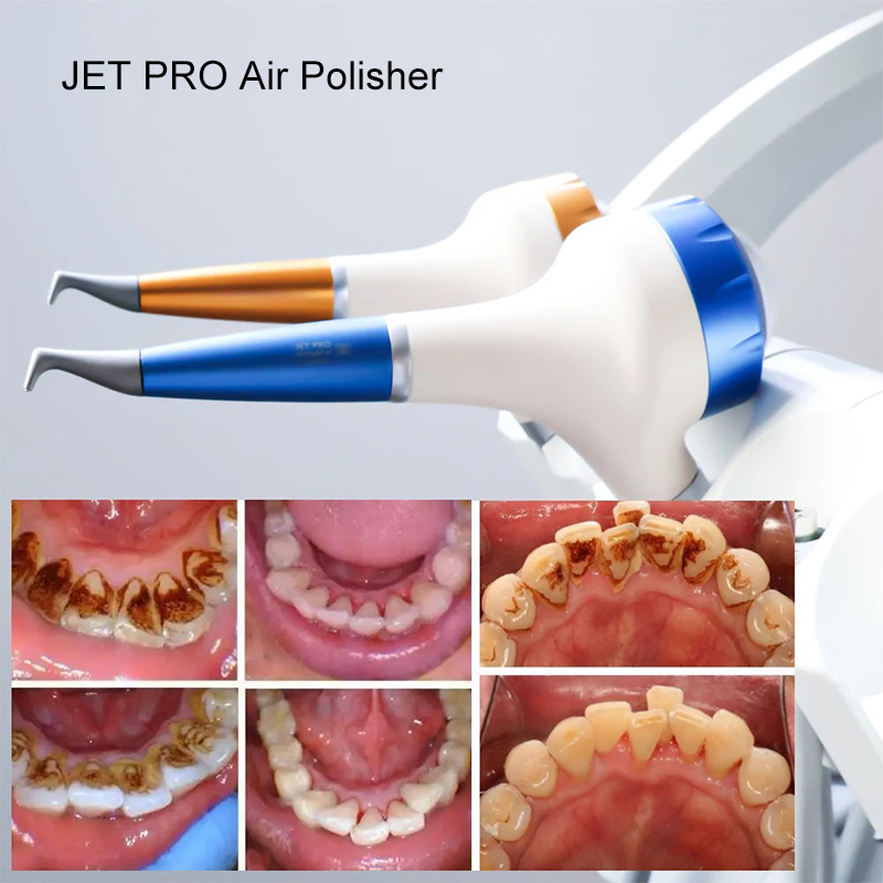 VV Dental  Air Polishing Proph – обзор и цена Teeth Whitening China