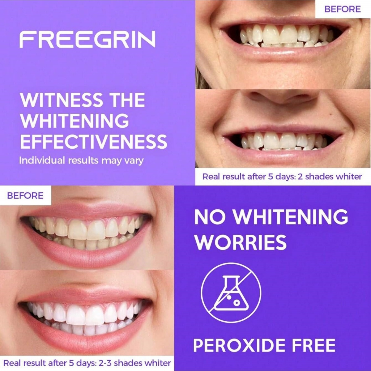 Deluxe Whitening Teeth Sticker – обзор и цена Teeth Whitening Gels Used By Dentists