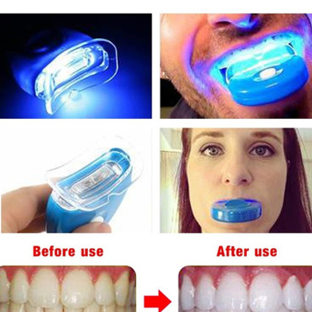 New Blue Led Teeth Whitening A – обзор и цена Teeth Whitening Laser