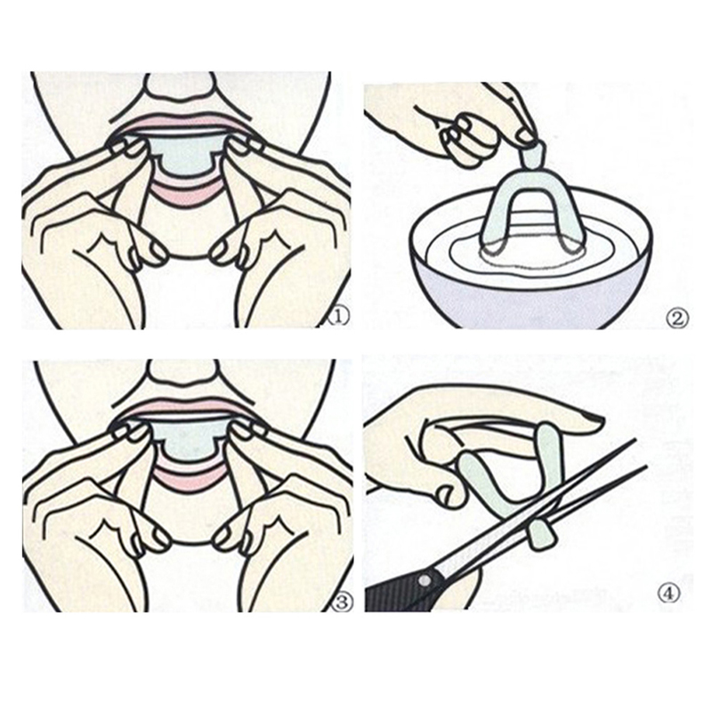 10Pcs Teeth Whitening Night Gu – обзор и цена Teeth Whitening For Trays