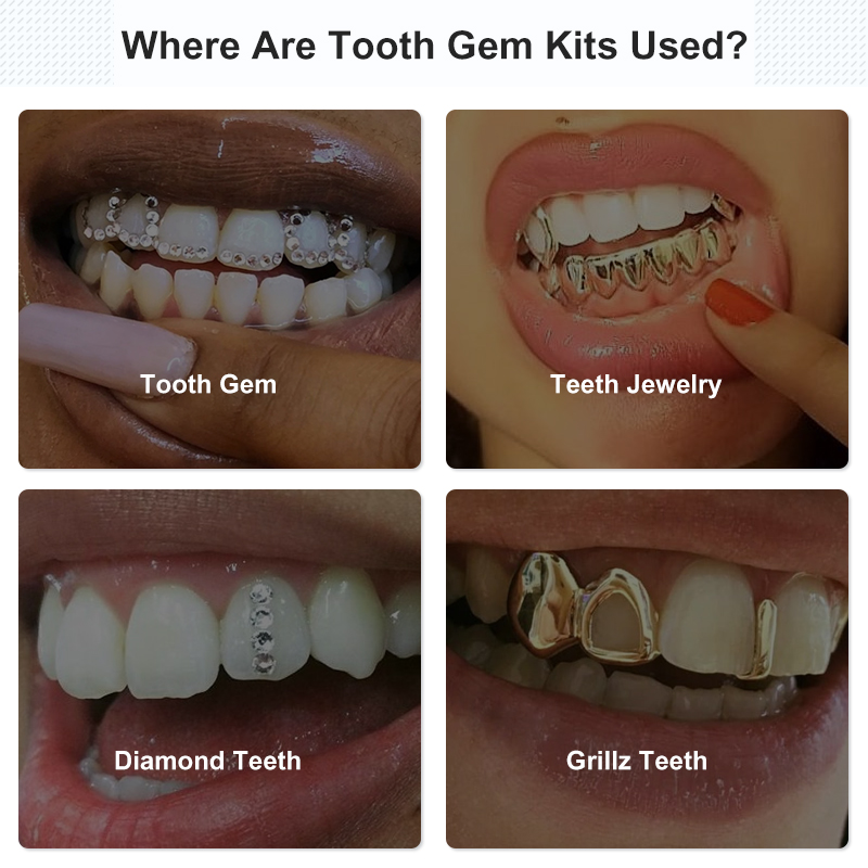 Tooth Gem Set Glue Kit with UV – обзор и цена Uv Whitening Kit