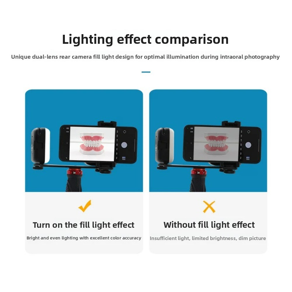 Dental Photography Light, Blue – обзор и цена Teeth Whitening Light Kit