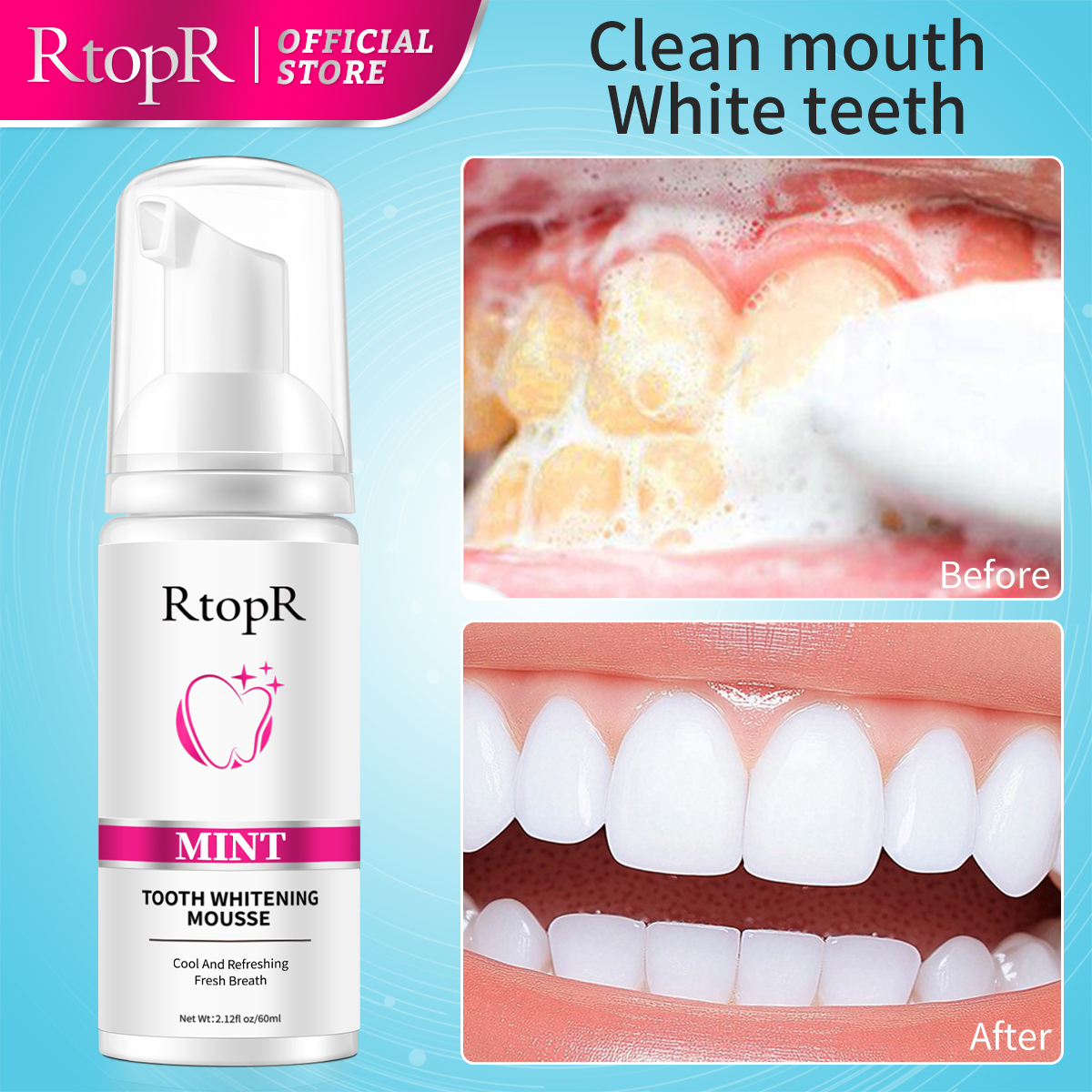 RtopR Mint Whitening Teeth Mou – обзор и цена Teeth Whitening Xylitol