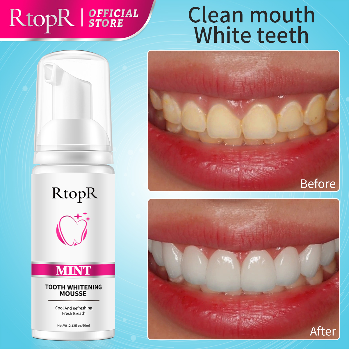 RtopR Mint Whitening Teeth Mou – обзор и цена Teeth Whitening Xylitol