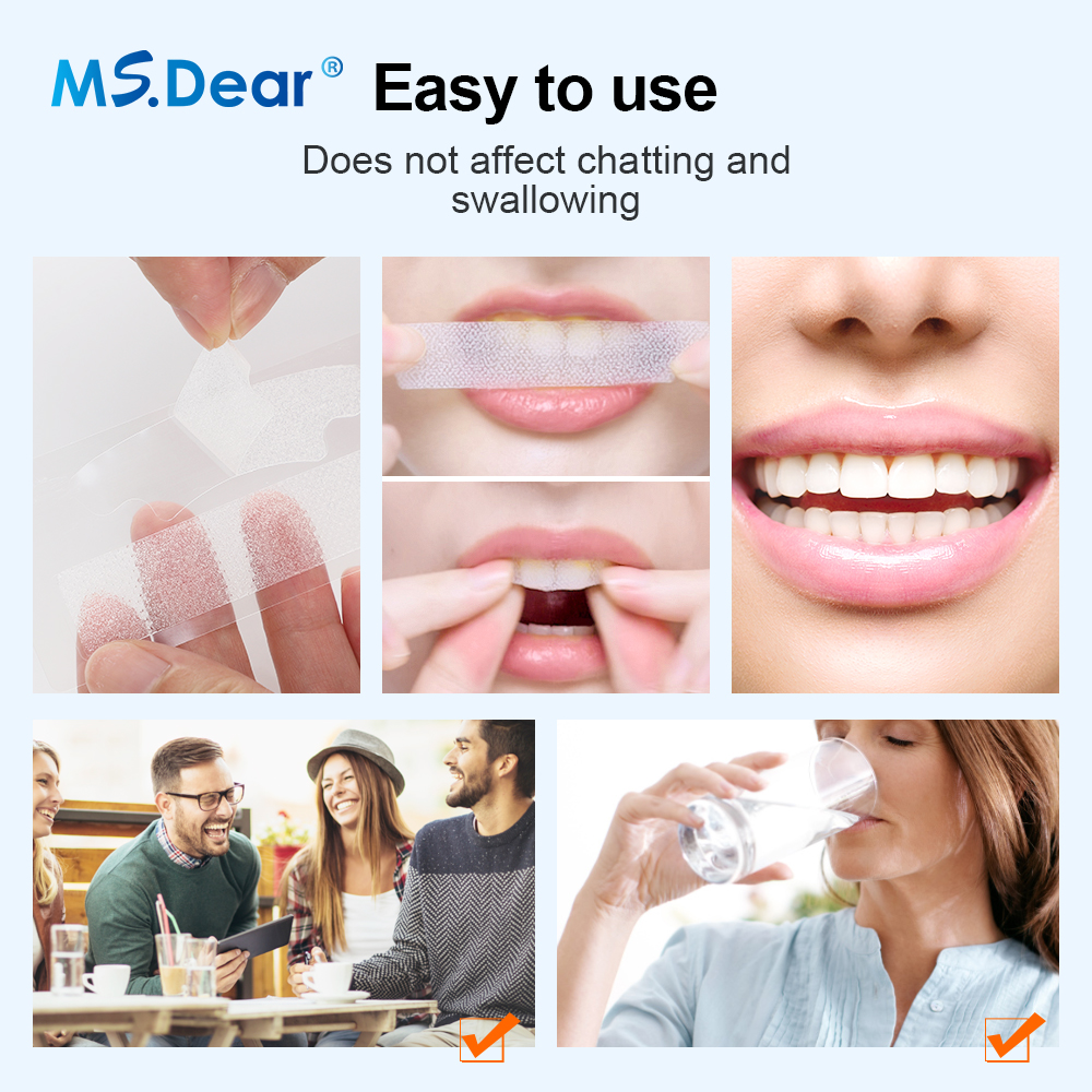 Teeth Whitening Strips Cleansi – обзор и цена Teeth Whitening Strips Crest